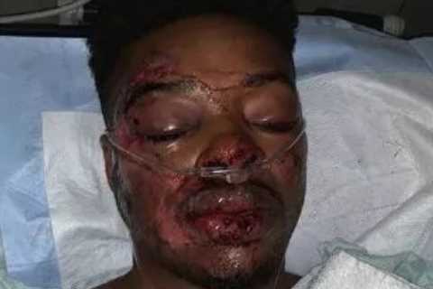 Errol Spence Jr pleads guilty to DWI after horror Ferrari smash that nearly killed him