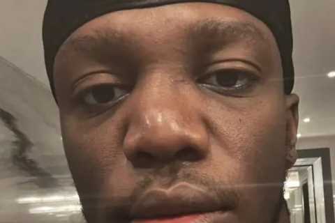 KSI shows off gruesome broken nose but British YouTube star still set to fight Alex Wassabi in boxing return