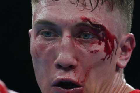 Commonwealth Games boxer Billy McAllister suffers horror cut from clash of heads that sees bout halted in final round