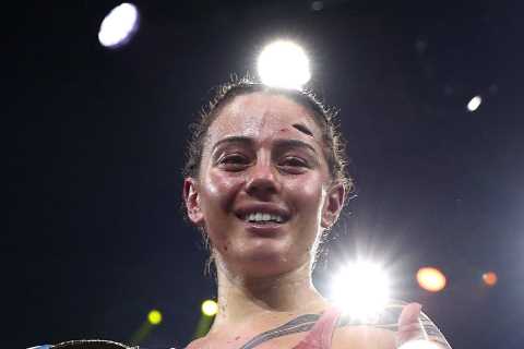 World champ Cherneka Johnson shows off horror gash and left bloodied mess after brutal war with Susie Ramadan