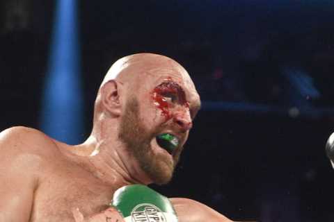 Otto Wallin gives fellow southpaw Oleksandr Usyk tips on how to fight Tyson Fury after giving WBC champ 47 stitches