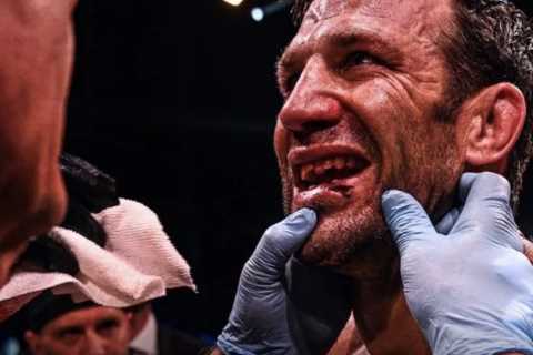 Ex-UFC champion Luke Rockhold quits in brutal bare-knuckle fight with Mike Perry after having his TEETH knocked out