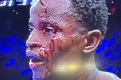 Boxing match STOPPED after fighter suffers horror head injury as he is left with blood pouring down face