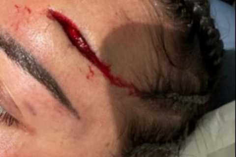 Boxing stunner Cherneka ‘Sugar Neekz’ Johnson puts gruesome head injury behind her as she prepares for Ellie Scotney
