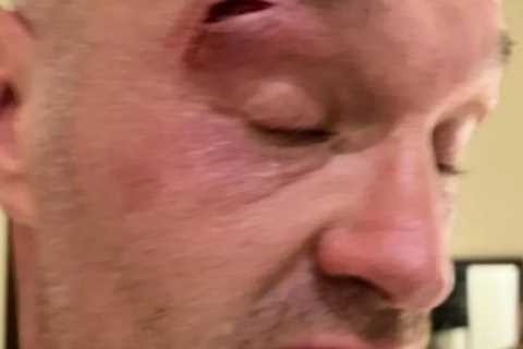 Amir Khan Reveals Advantage for Oleksandr Usyk in Tyson Fury Fight