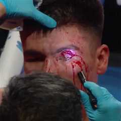 Boxers Suffer Gruesome Cuts in Brutal Fight