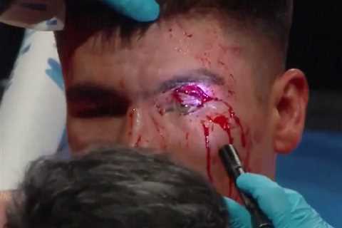 Boxers Suffer Gruesome Cuts in Brutal Fight