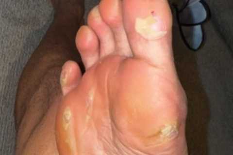 Eubank Jr's Battered Feet Spark Drama as Hearn Suggests Excuse-Making Before Benn Showdown