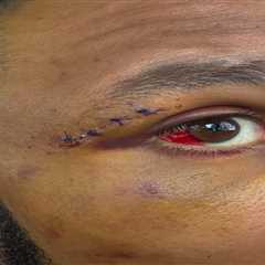 Eubank Jr. flashes mangled eye on Netflix set after dad claims he nearly died in Benn bloodbath